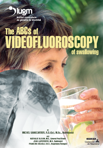 The ABC’s of Videofluoroscopy of Swallowing (DVD)